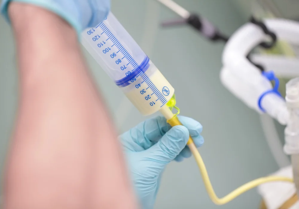 Enteral Feeding – NDIS Complex Care & Nursing from Montessori Care
